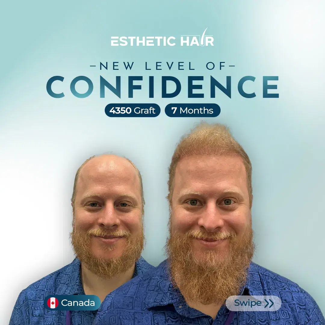 combined-7