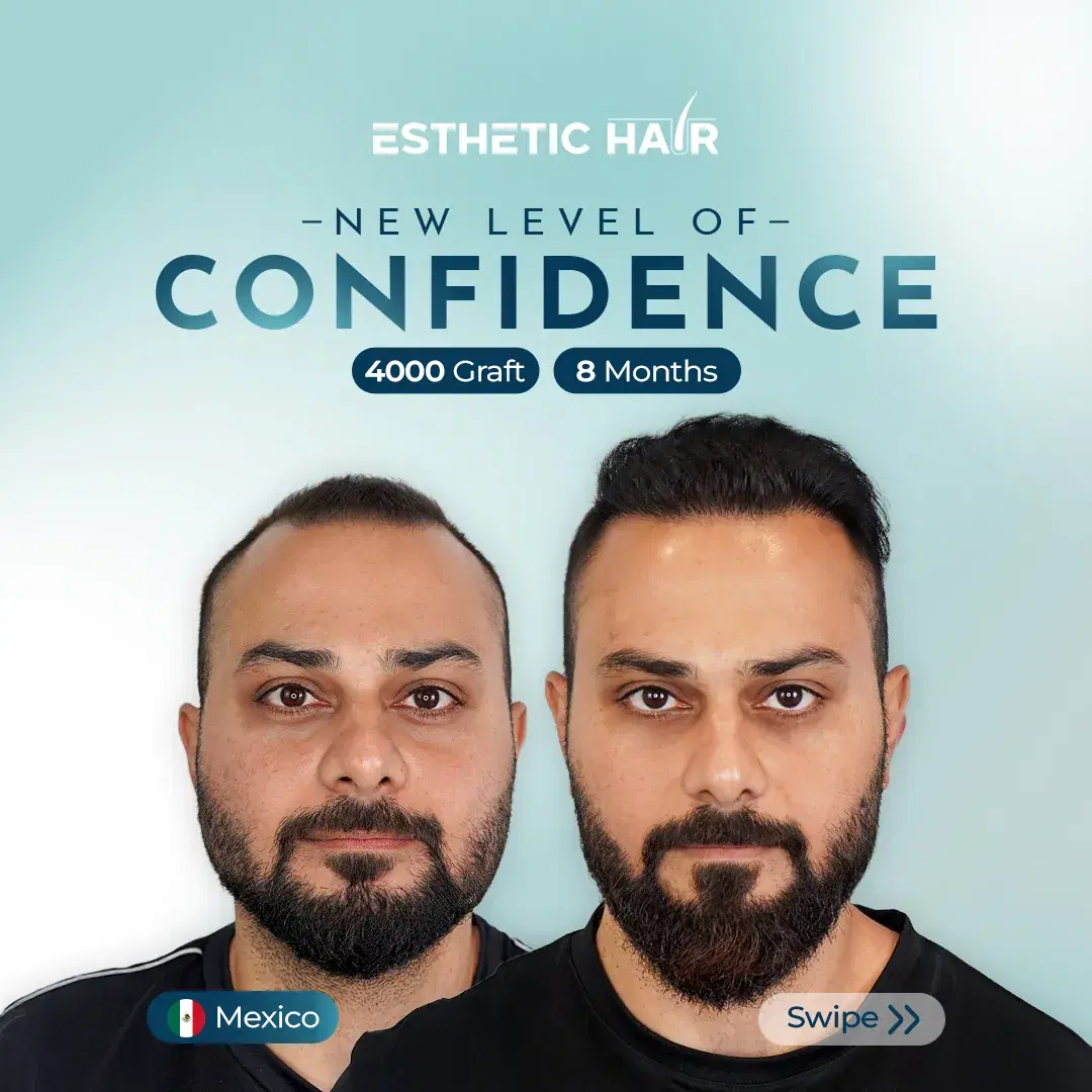 combined-8