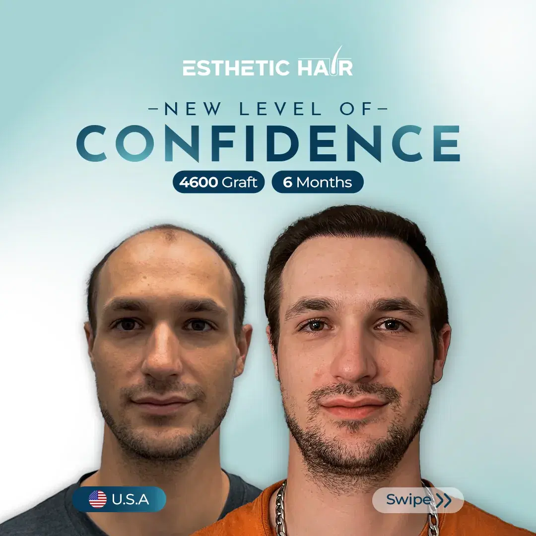 combined-3
