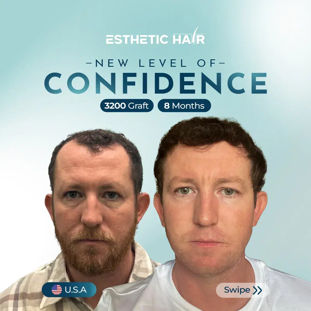 combined-5