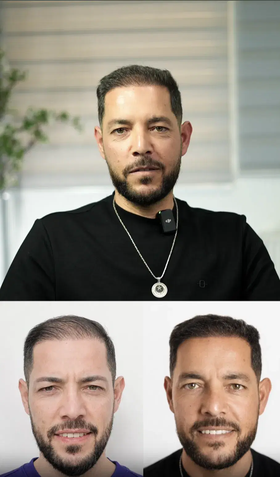 12 Month Transformation Timeline